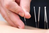 Acupuncture is Back at Total Health Systems, Clinton Township Location!