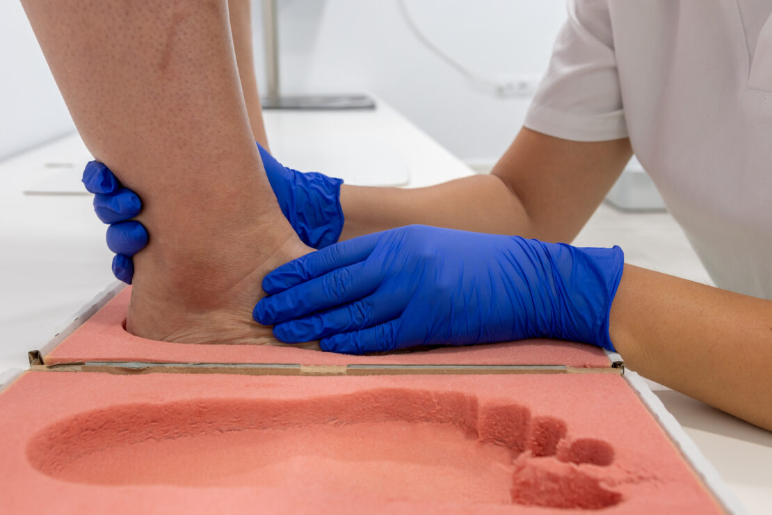 A medical professional is wearing blue nitrile gloves as they grasp and place someone's foot into a mold.