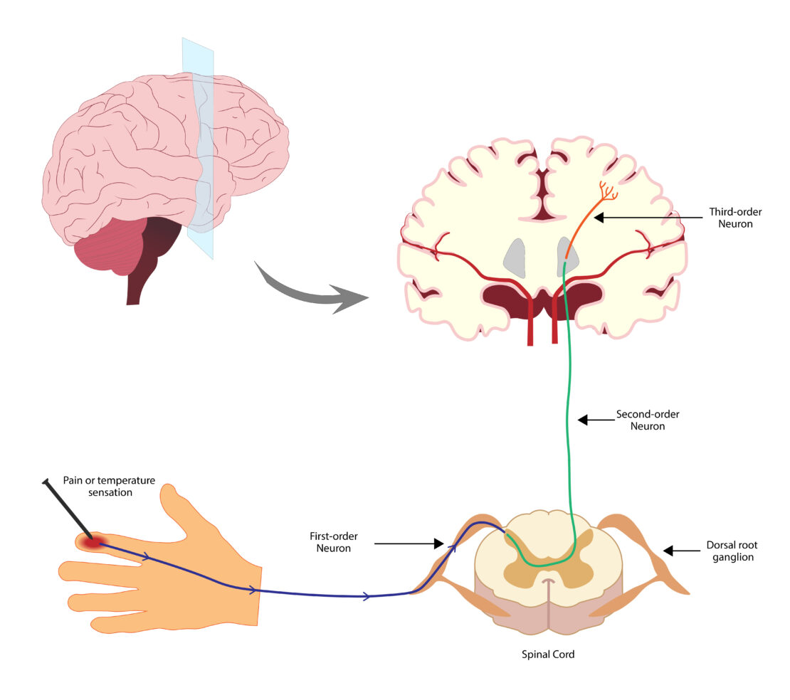 An illustration showing how pain works in the body. The first image is a hand with a red spot in the center—the red indicates pain or temperature sensation. It shows the pain being traveled to a first-order neuron that runs along the spinal cord. That pain signal is then sent to the second-order neuron that runs from the spinal cord to the brain, and then to the third-order neutron in the brain where the pain is processed.