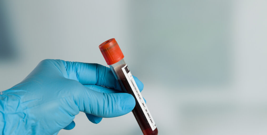 A gloved hand holds a labeled tube filled with blood